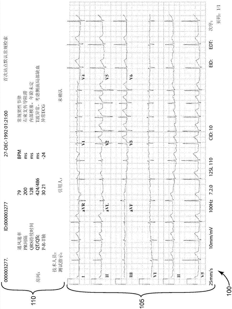 用于为电子医疗记录(emr)提供心电图(ecg)分析的系统的制作方法