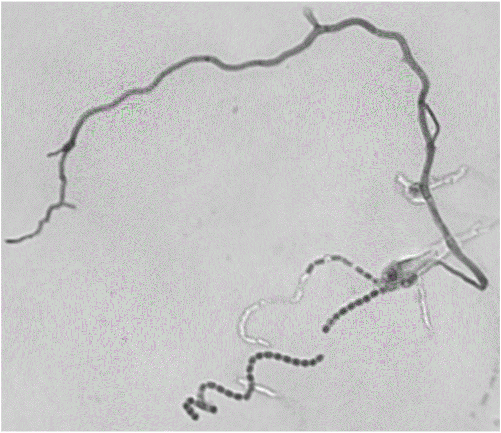 一株链霉菌属放线菌及其用途的制作方法