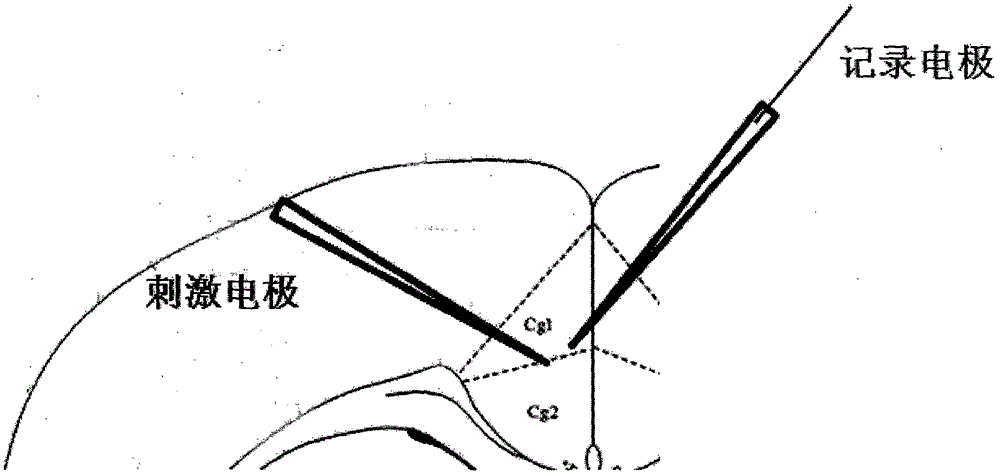 一种在小鼠前扣带回皮层诱发dse现象的方法与流程