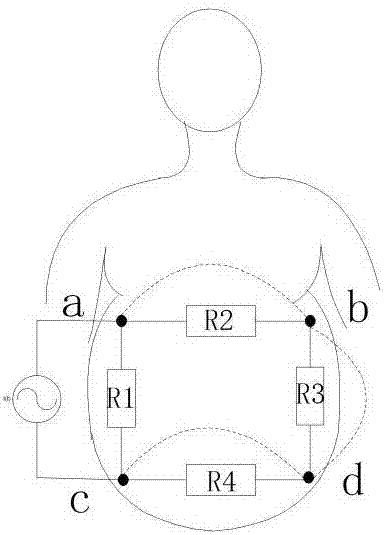一种孕妇腹部分段阻抗测量方法以及胎儿体重估算方法与流程