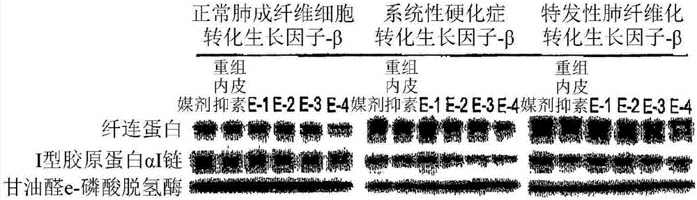 用于治疗纤维化的内皮抑素片段和变体的制作方法