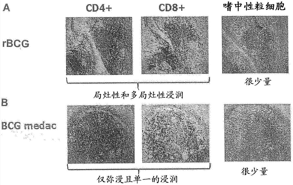 重组分枝杆菌作为免疫治疗剂用于治疗癌症的制作方法