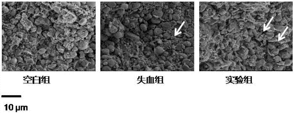 富勒烯在制备药物中的用途以及保护脾脏的药物的制作方法