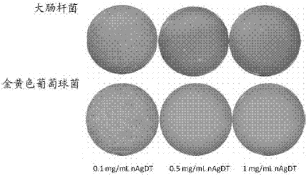 骨水泥、其制备方法和用途与流程