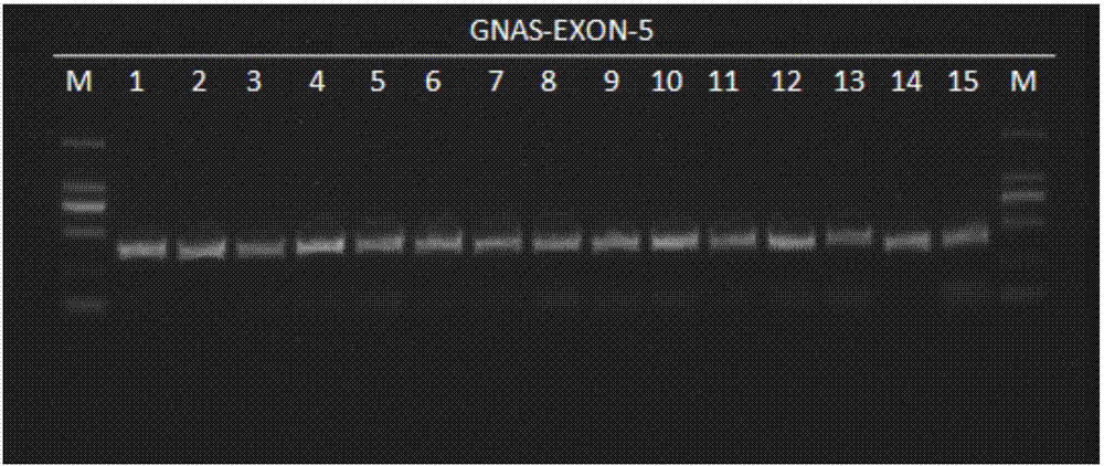 检测GNAS基因位点突变的引物和方法与流程