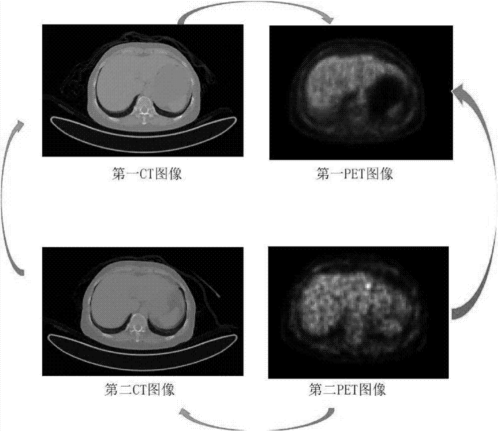 一种医学图像的配准方法,装置及设备与流程