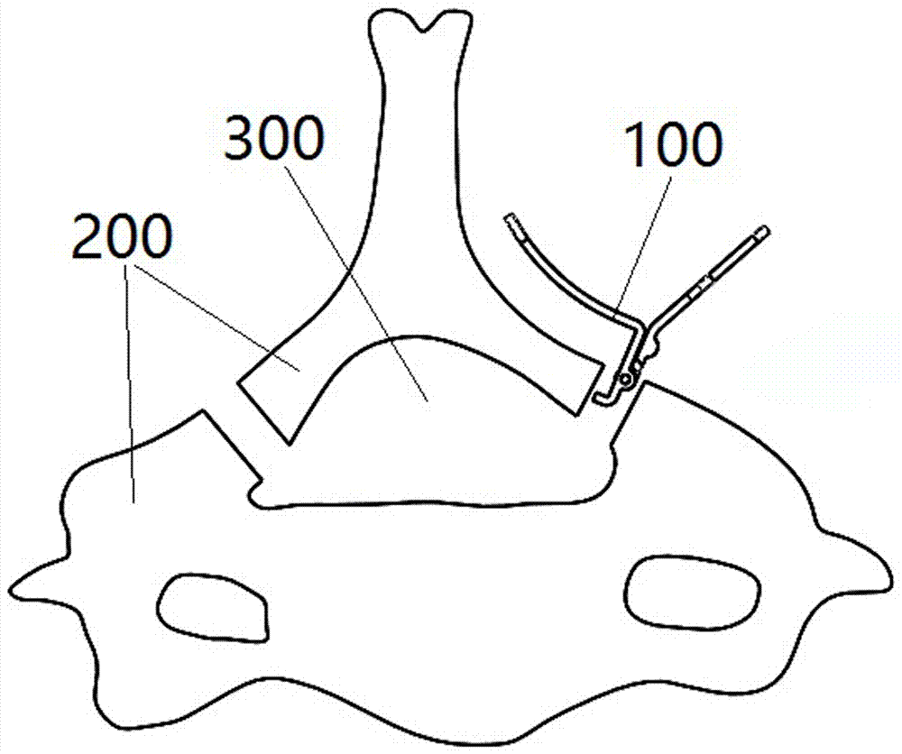 一种椎体钢板的制作方法