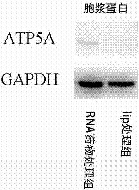 一种结合α亚基的F1F0-ATP合成酶RNA抑制剂及应用的制作方法