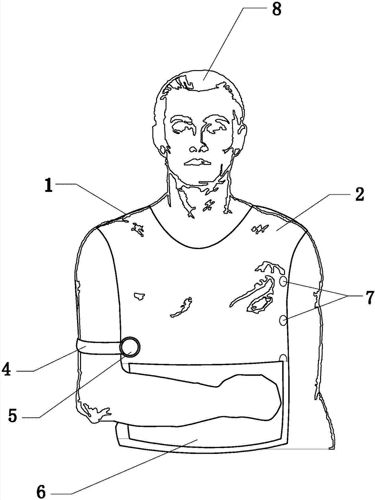 肩关节脱位侧上肢固定上衣的制作方法
