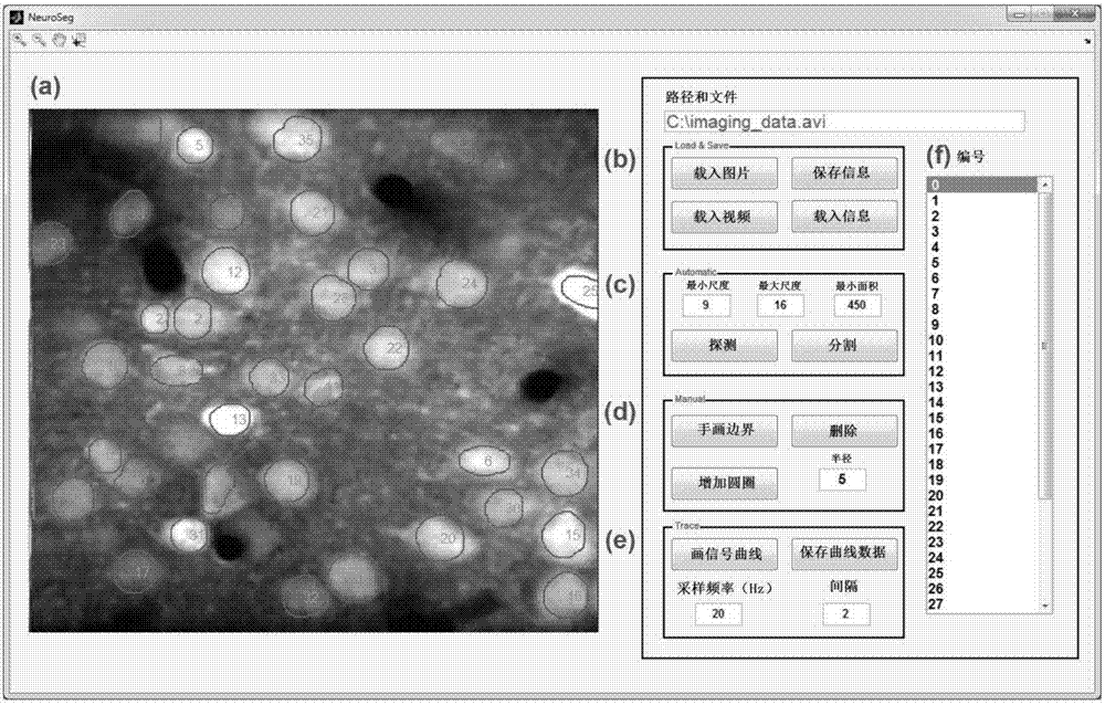 基于双光子成像数据的细胞自动探测和分割方法与流程