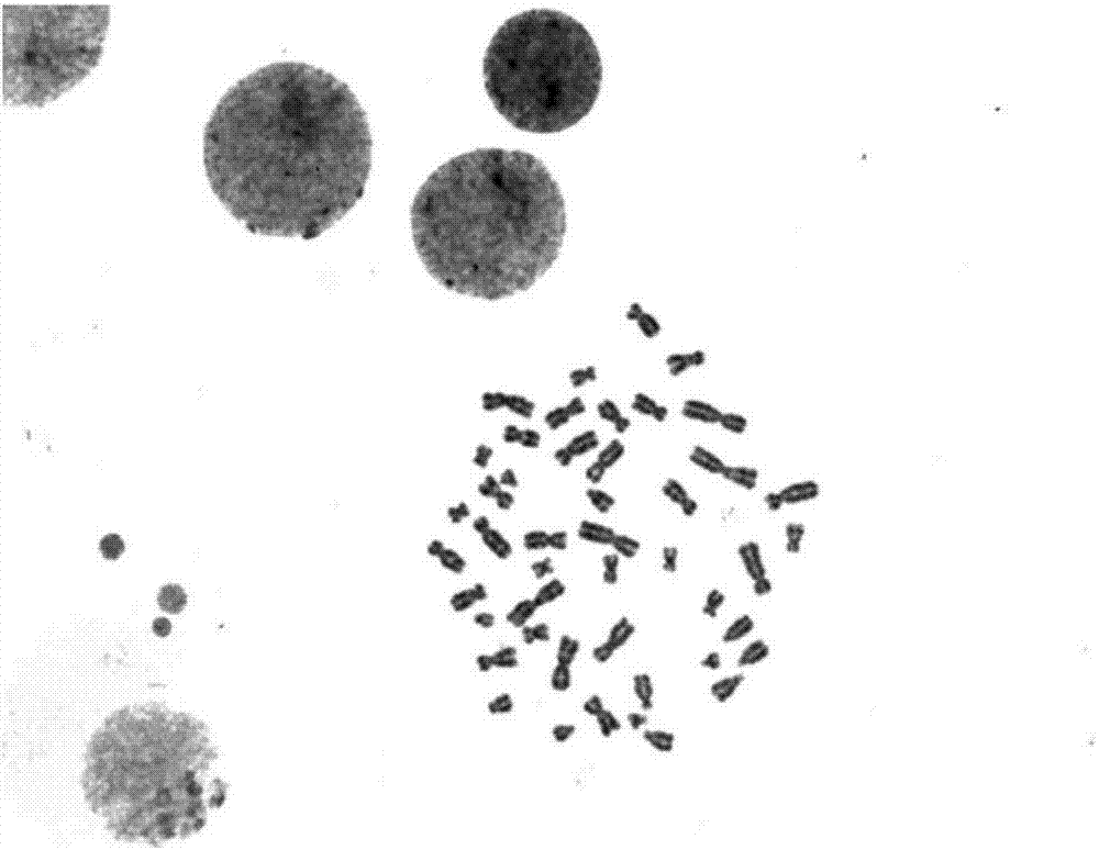 一种骨髓染色体G带的制作方法与流程