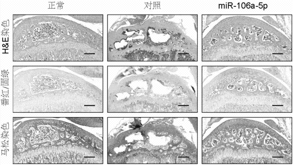 miR-106a-5p抑制骨关节炎软骨基质降解的制作方法