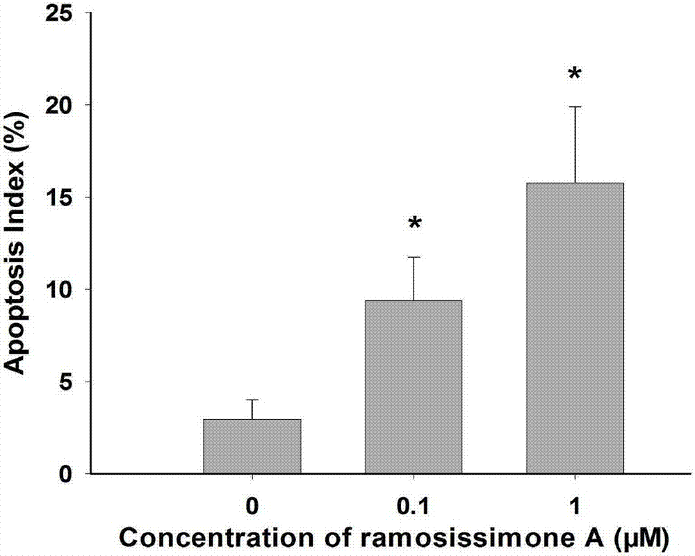 Ramosissimone A在制备治疗类风湿关节炎药物的应用的制作方法