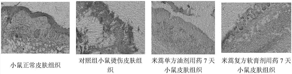 一种用于烧烫伤的米蒿复方制剂及其制备方法与流程