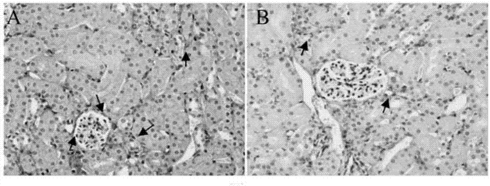 预防和治疗药物性肾损伤的药物及其用途的制作方法