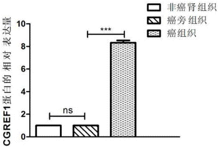 CGREF1作为标志物在肾透明细胞癌诊疗中的应用的制作方法