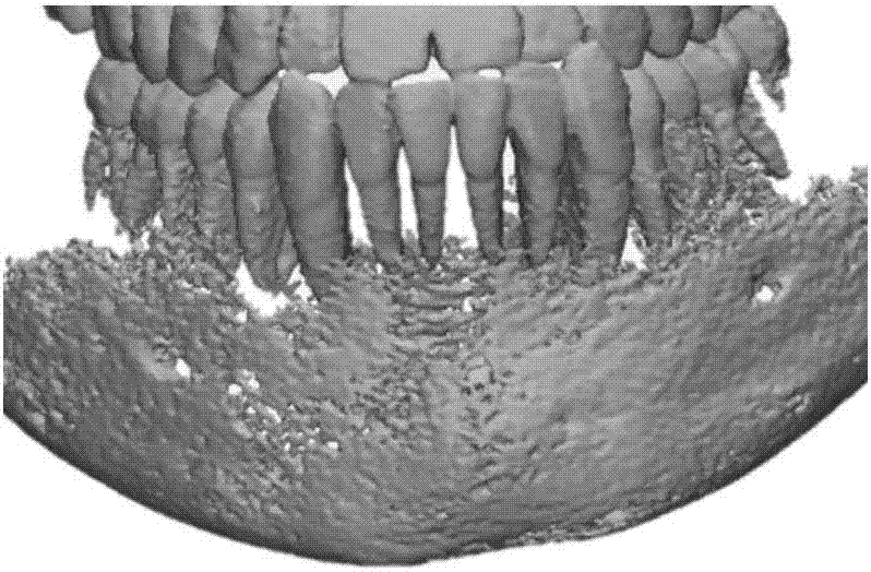 一种基于DICM数据的牙颌系统有限元建模方法与流程