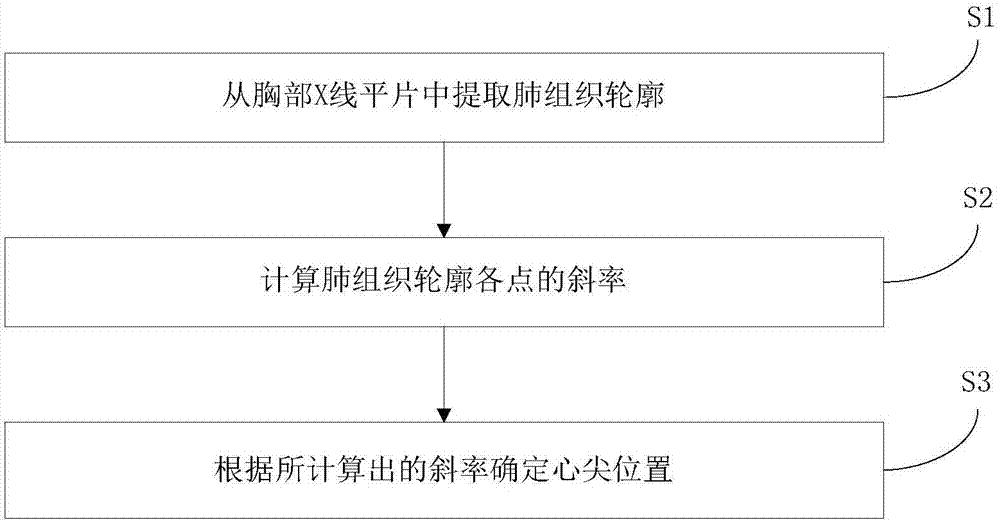 一种用于识别胸部X线平片中心脏方位的方法和装置与流程