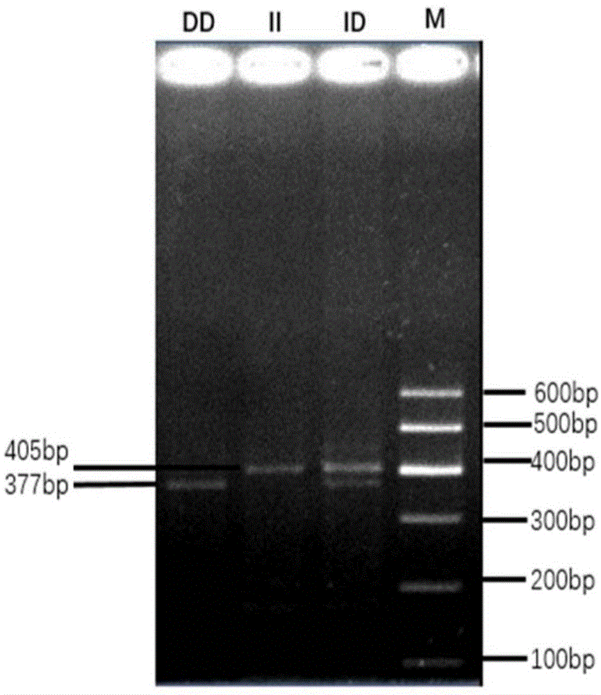 一种黄牛IGF1R基因插入/缺失的检测方法及其应用与流程
