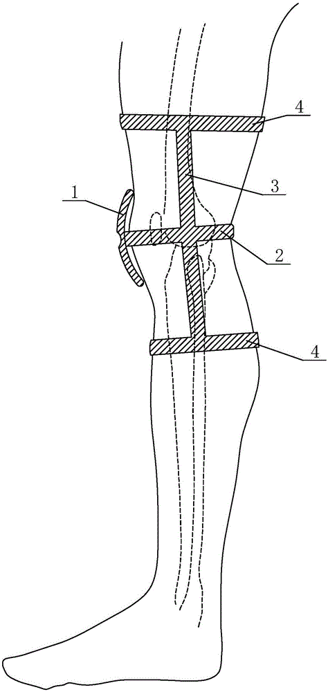 腿围测量装置的制作方法
