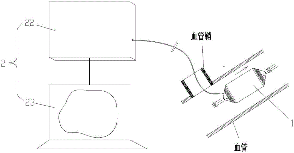 一种可精确控制的血管手术机器人及其操作方法与流程