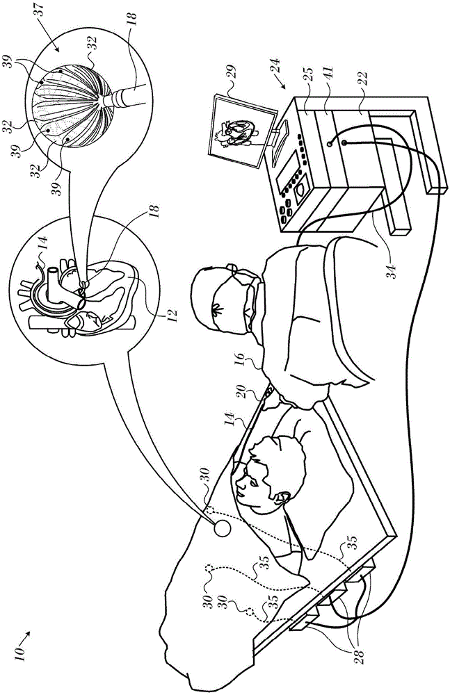 在球囊导管的预先确定的半径上的超声换能器的制作方法