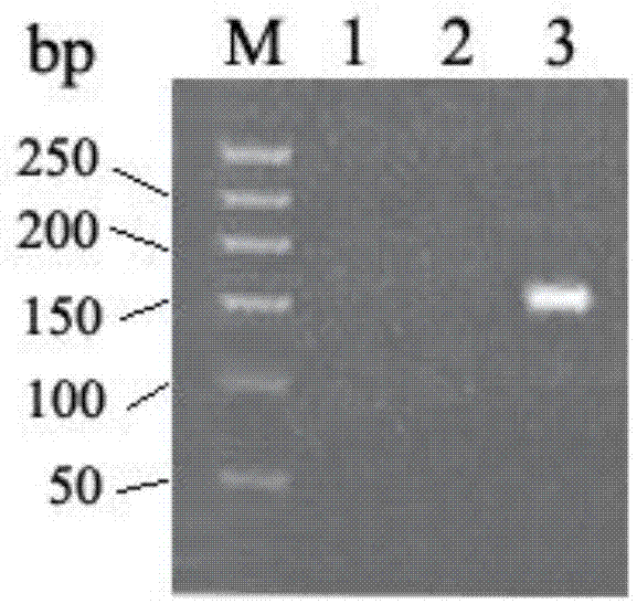 BRCA1基因g.43063754T>G突变体及其在乳腺癌辅助诊断中的应用的制作方法