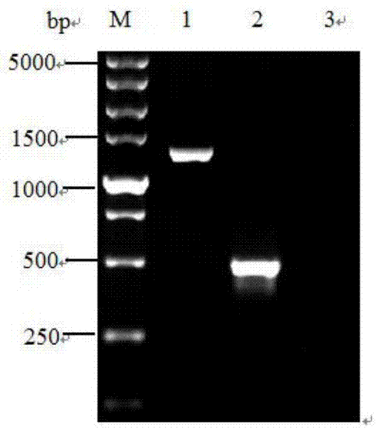 炭疽杆菌双重荧光定量PCR检测试剂盒及检测方法与流程