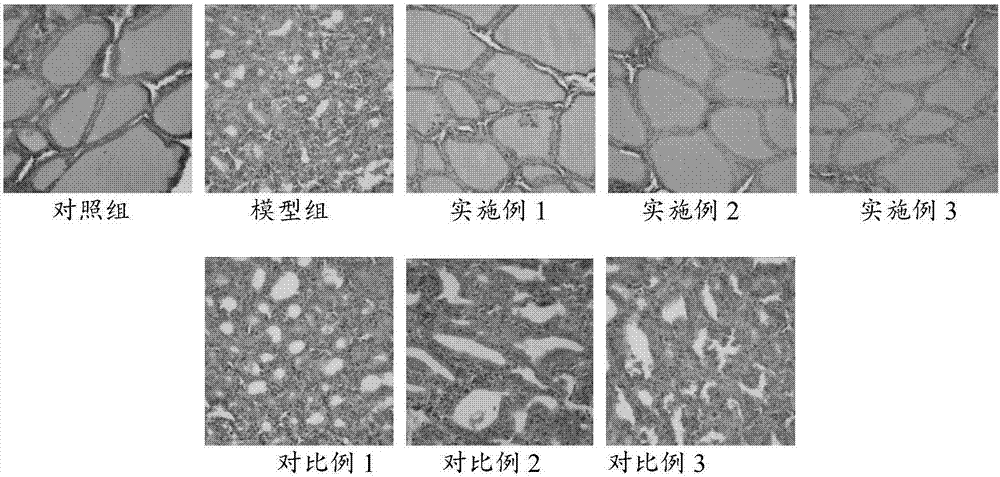 一种用于缓解甲状腺结节及甲减功效的组合物及其应用的制作方法