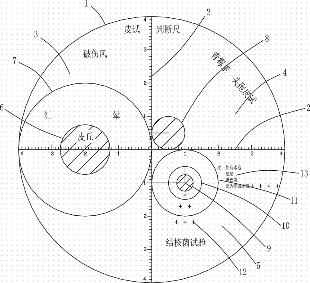 一种皮试结果判断尺的制作方法