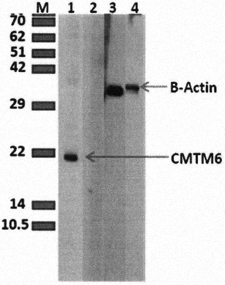 鼠抗人CMTM6蛋白单克隆抗体制备及用途的制作方法