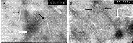 一种烟草脆裂病毒粒体原位分离固定电子显微镜诊断方法与流程