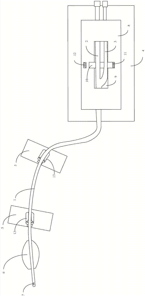 一种导尿管固定装置的制作方法