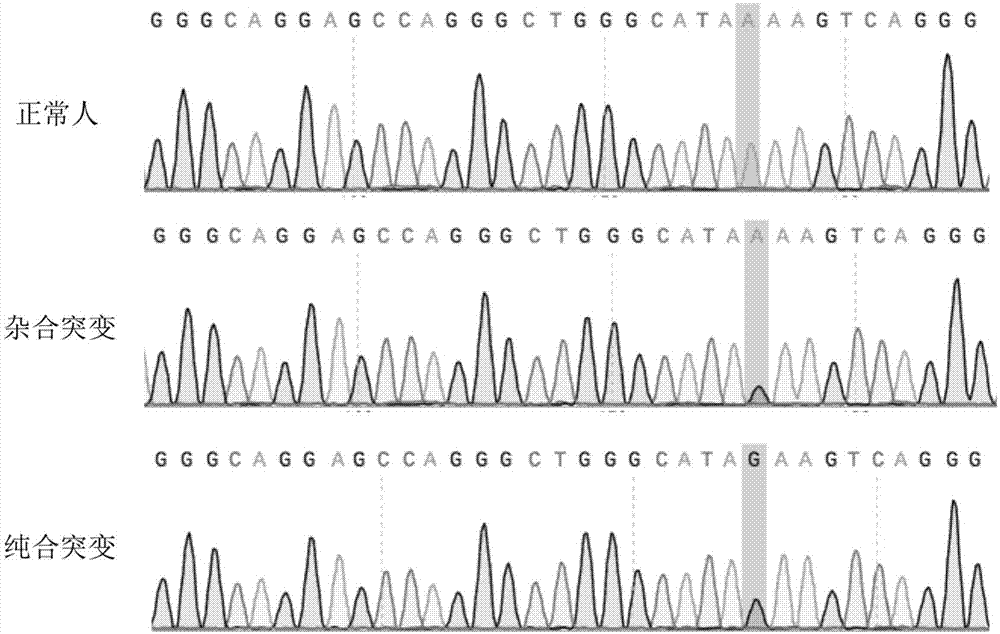 基于CRISPR/Cas9技术编辑HBB-28突变位点的sgRNA、载体及应用的制作方法