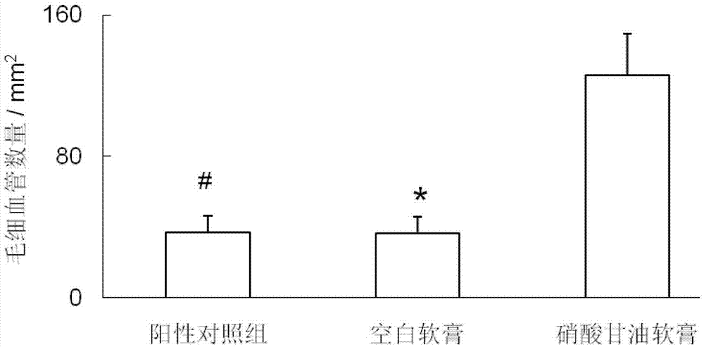 硝化甘油在制备治疗慢性肢体缺血性疾病药物中的应用的制作方法