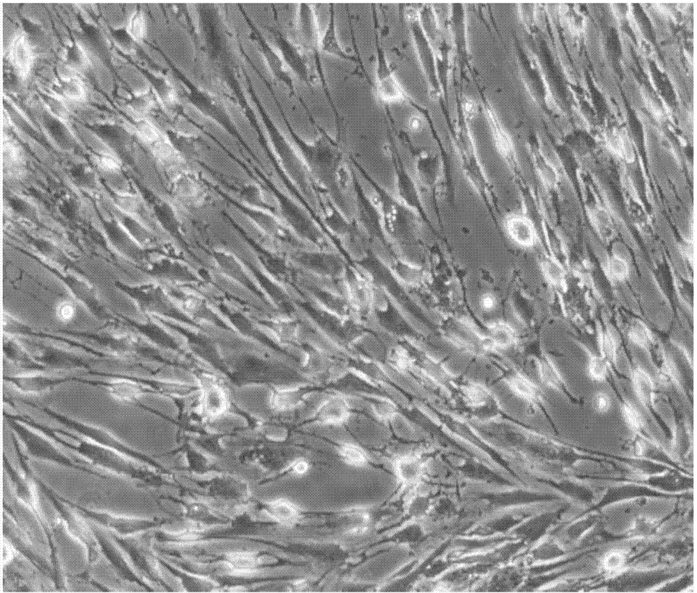 一种人颅骨间充质干细胞来源的神经元样细胞的悬浮培养方法与流程