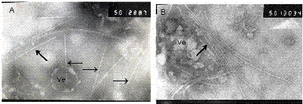 一种马铃薯Y病毒粒体的原位分离固定电子显微镜诊断方法与流程