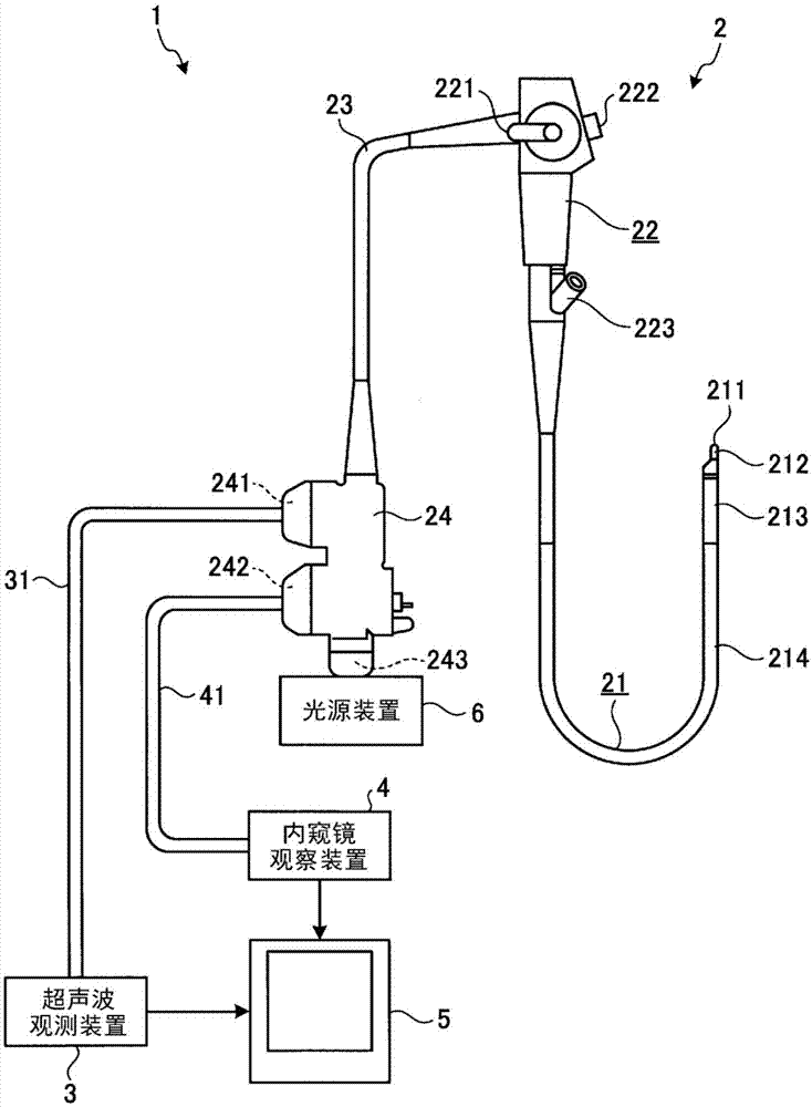 超声波内窥镜的制作方法