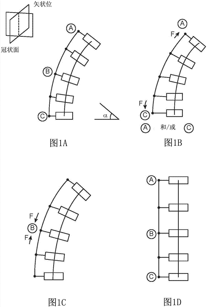 脊柱弯曲调节系统的制作方法