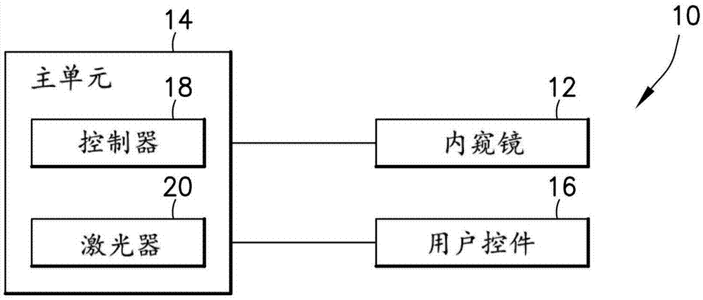 用于激光碎石术的设备的制作方法