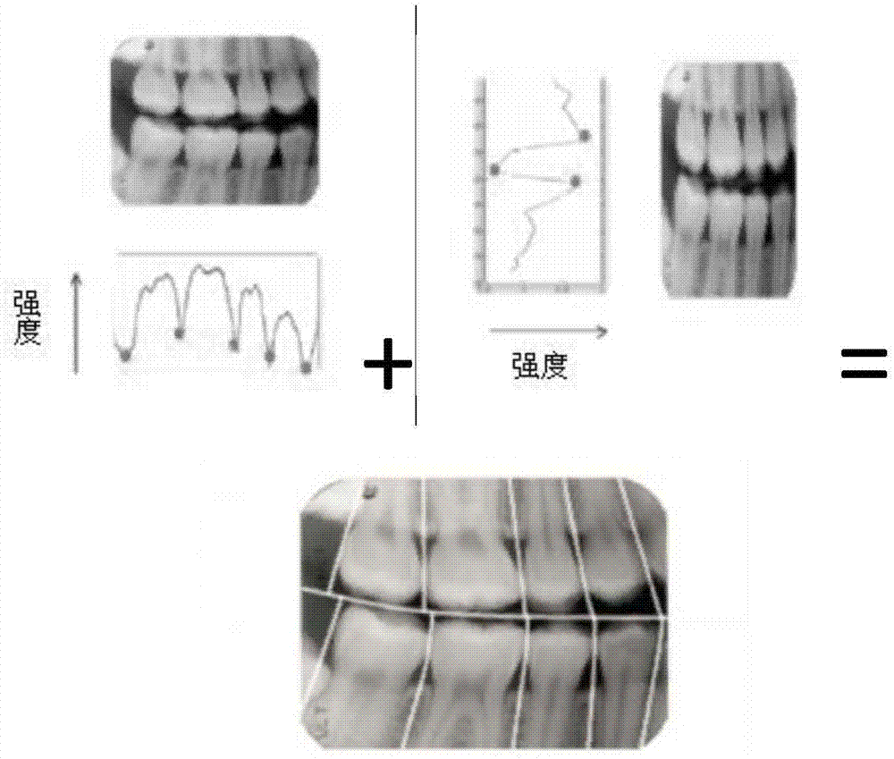 口腔曲面CT图像生物特征提取及匹配方法和设备与流程