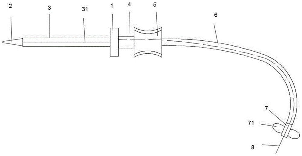 一种导丝导引式外周中心静脉置管导管的制作方法