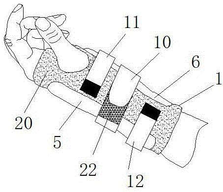 一种贴合性好的手腕护具的制作方法