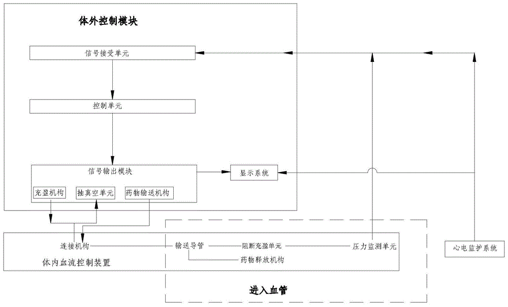 心脏冠状静脉灌注系统及其控制方法与流程