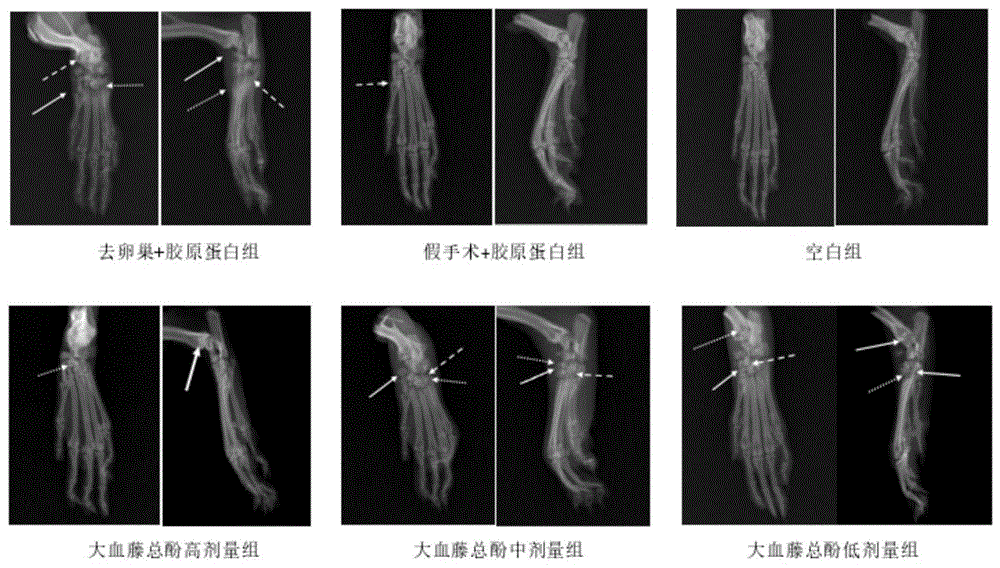 一种大血藤总酚提取物的制备方法及应用与流程