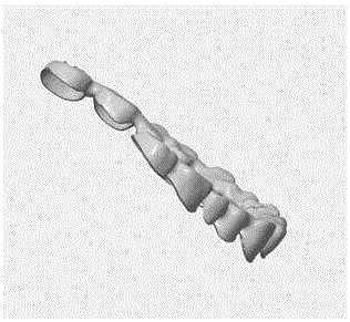 一种基于三维打印的牙冠模型自动方向优化方法与流程