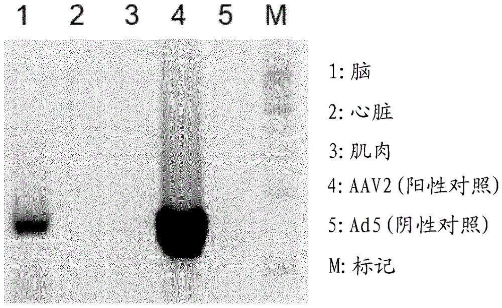 腺相关病毒(AAV)衣壳蛋白的突变体的制作方法