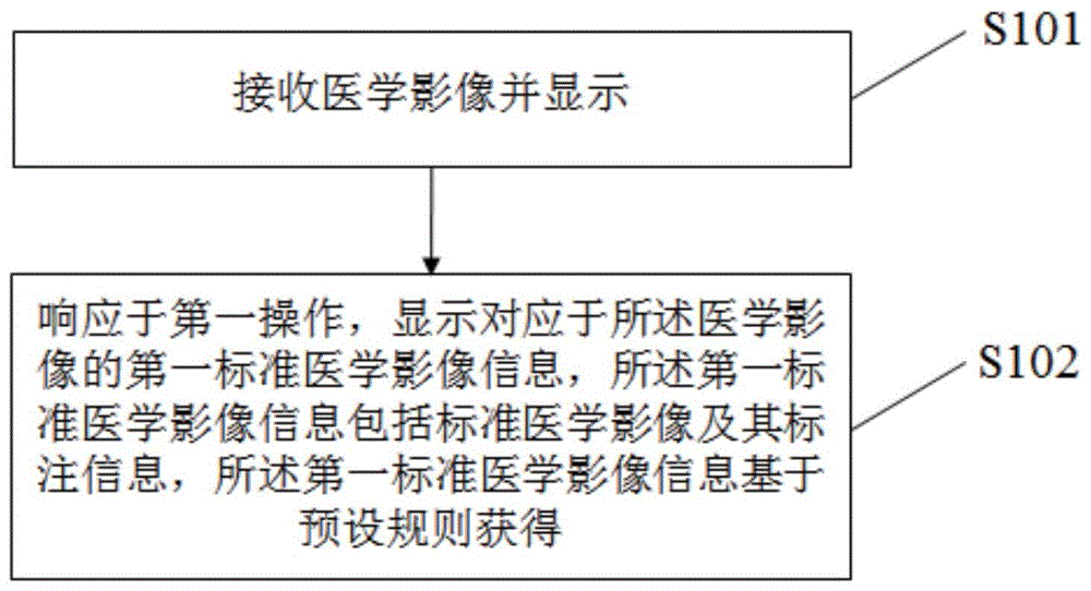 医学影像显示方法和显示设备与流程