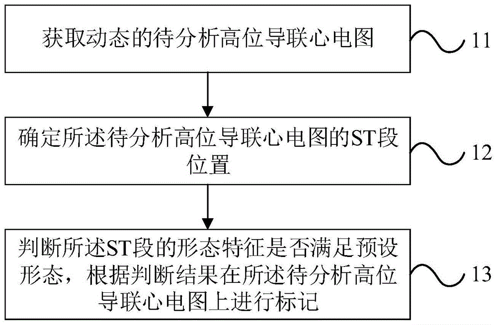 一种导联心电图的分析方法及装置与流程