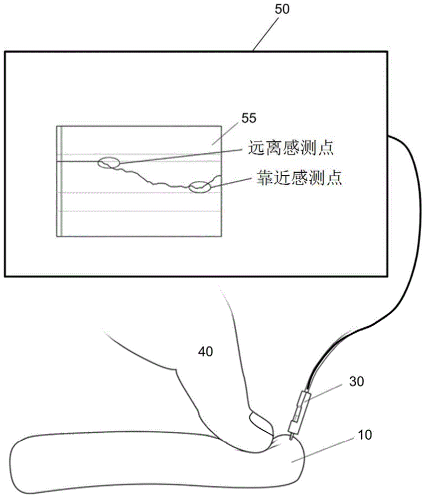 传感器装置及方法与流程